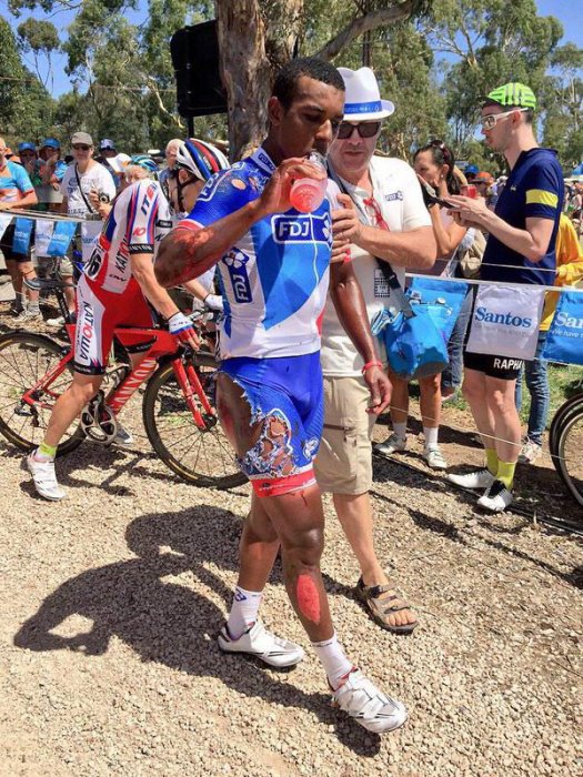 http://www.matosvelo.fr/public/Actu/Tour_Down_Under/2015/Chute_Mount_Barker/.Lorenzo-Manzin-FDJ-TDU2015-2_m.jpg